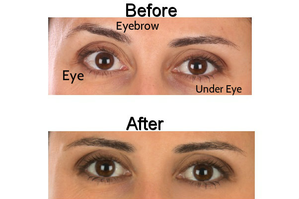 Before and After Eyes 2